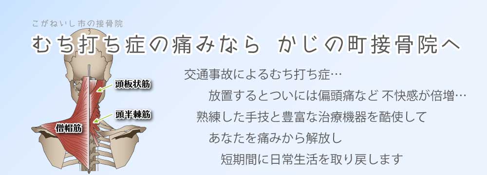 むち打ち症の痛みなら かじの町接骨院へ